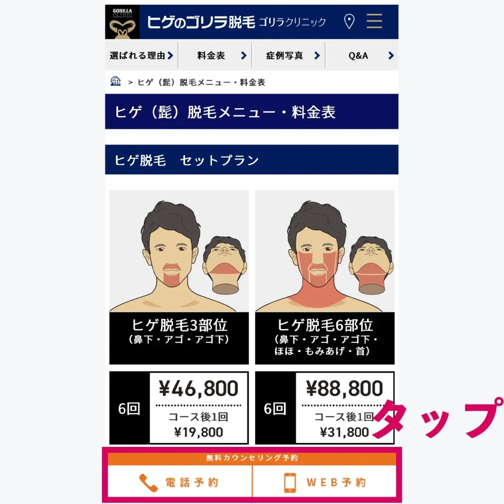 ゴリラクリニックのスマホでの予約方法